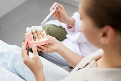 san jose dental implants | patient at implants model